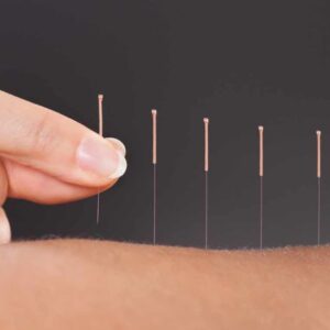 Acupunctura-y-menopausia-881x448 Acupunctura-y-menopausia-881x448